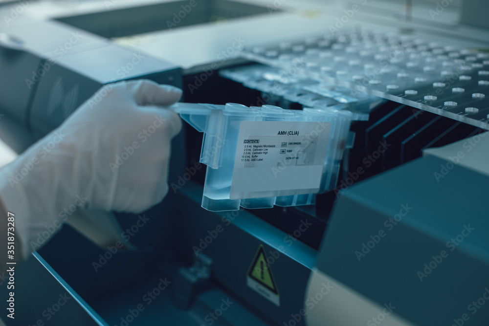 Hand of lab scientist holding box with reactive chemical