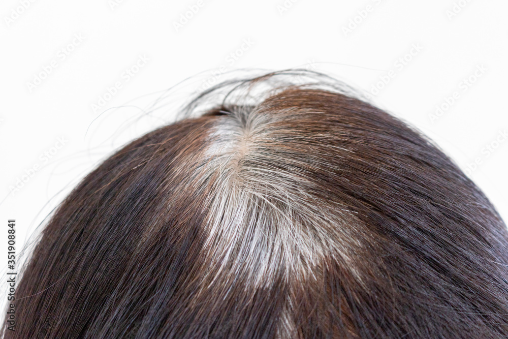 染めた後に生えてきた白髪の高齢女性の頭