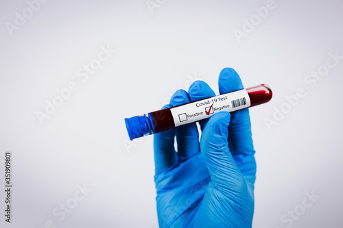 Hand holds a test tube containing a blood negative sample, test tube with blood for Covid-19 (coronavirus) analyzing. Laboratory testing patient’s blood. Blue nitrile glove.