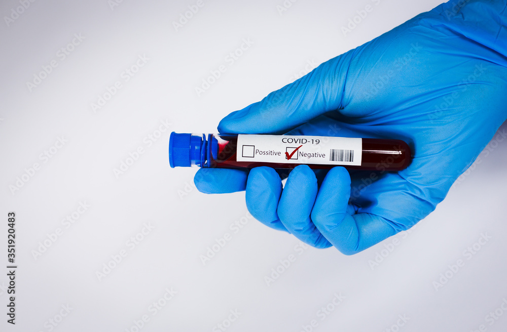 Obraz premium Hand holds a test tube containing a blood negative sample, test tube with blood for Covid-19 (coronavirus) analyzing. Laboratory testing patient’s blood. Blue nitrile glove.
