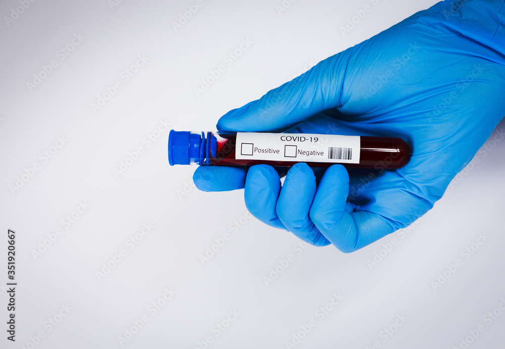 Obraz premium Hand holds a test tube containing a blood sample, test tube with blood for Covid-19 (coronavirus) analyzing. Laboratory testing patient’s blood. Blue nitrile glove.