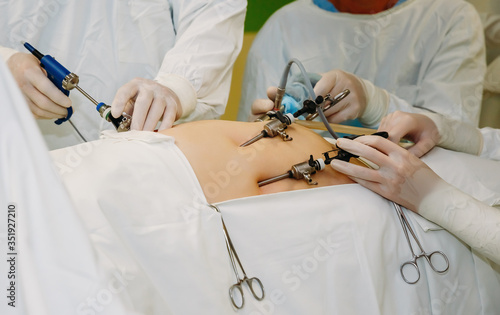 The work of surgeons using endo video of surgical instruments. Laparoscopy. Close-up. Abdominal surgery of a fat or pregnant patient. Endoscopy. Operating room surgical hospital.