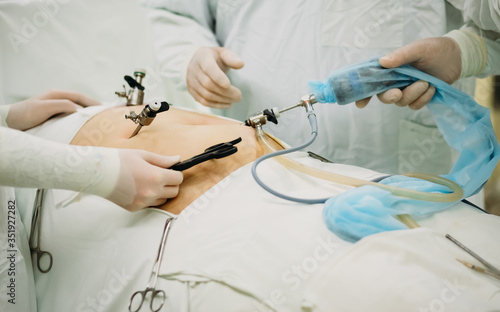 Close up of team surgeons hands during surgery with surgical laparoscopic instruments.