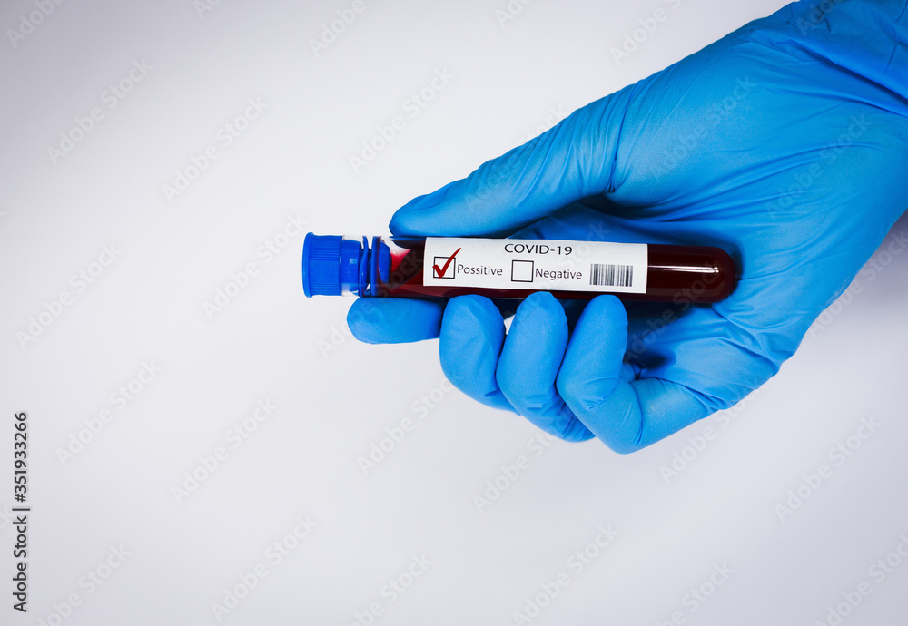 Obraz premium Hand holds a test tube containing a blood positive sample, test tube with blood for Covid-19 (coronavirus) analyzing. Laboratory testing patient’s blood. Blue nitrile glove.