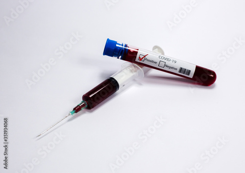 Test tube with blood sample Covid-19 (coronavirus). Laboratory blood test. syringe with blood. 
Covid-19 (coronavirus) positive test tube.
