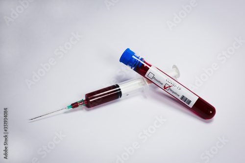 Test tube with blood sample Covid-19 (coronavirus). Laboratory blood test. syringe with blood. 
Covid-19 (coronavirus) negative test tube.
