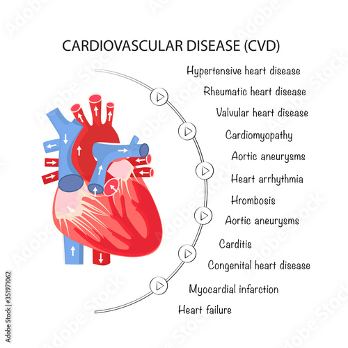 The human heart and all types of cardiovascular diseases. Poster for interns and medical institutions. Vector illustration of healthcare