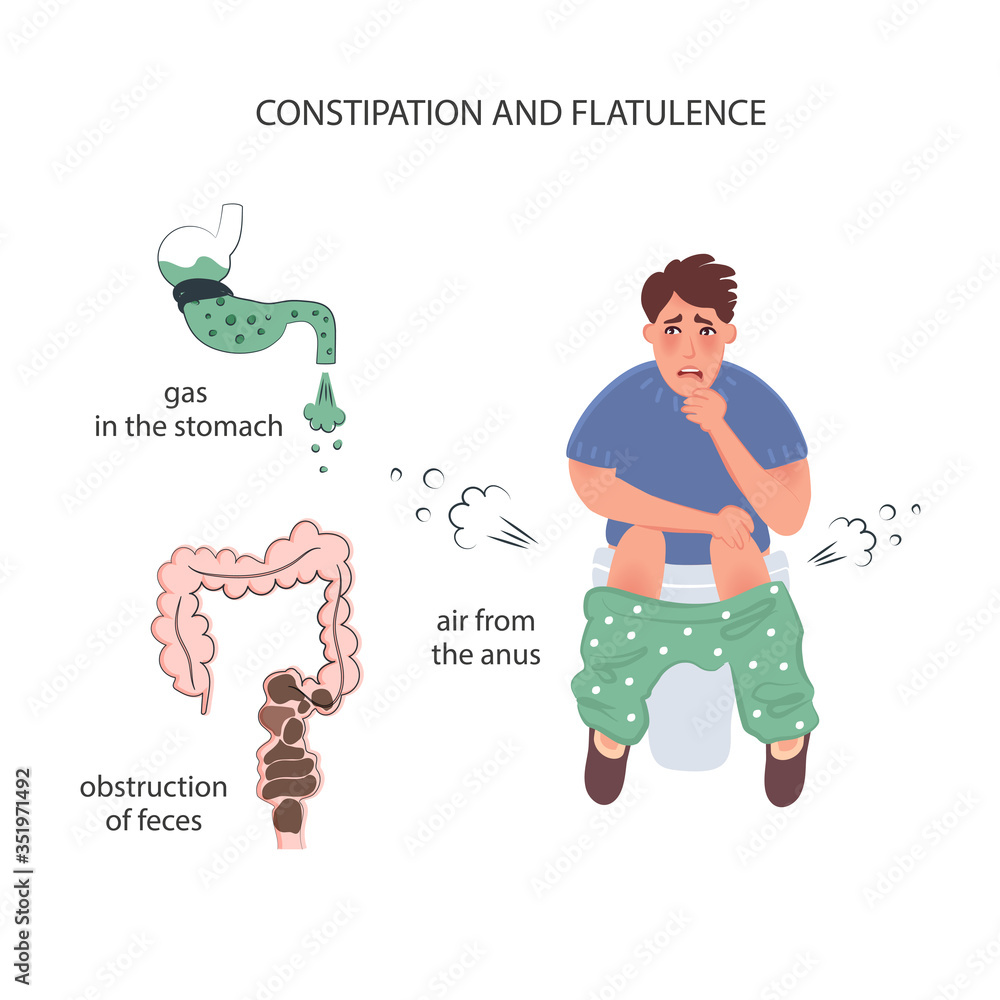 Constipation And Flatulence In Men Air Outlet Through The Anus Gas In 