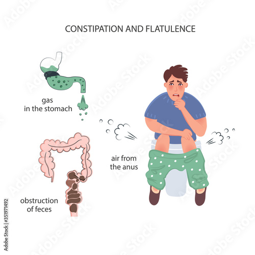 Constipation and flatulence in men. Air outlet through the anus. Gas in the stomach and fecal obstruction in the intestines. The vector of bloating