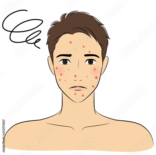 Man Confused about the Pimples on his Face. Skin Care. Vector illustration