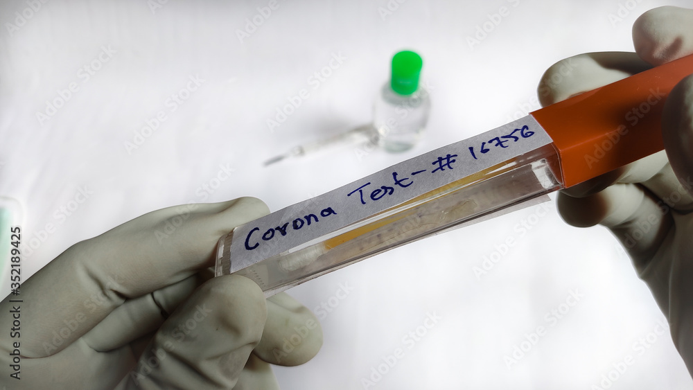 Obraz premium Corona virus testing in lab holding swab sample in hands