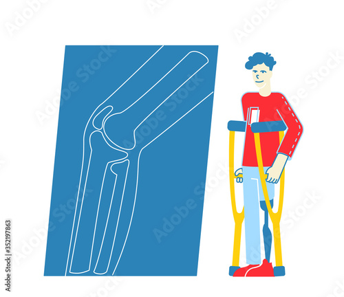 Invalid Handicapped Man Character Stand on Crutches with Leg Prosthesis Visiting Orthopedy Clinic or Hospital. Healthcare Disability, Medicine, Therapy Doctor Appointment. Linear Vector Illustration
