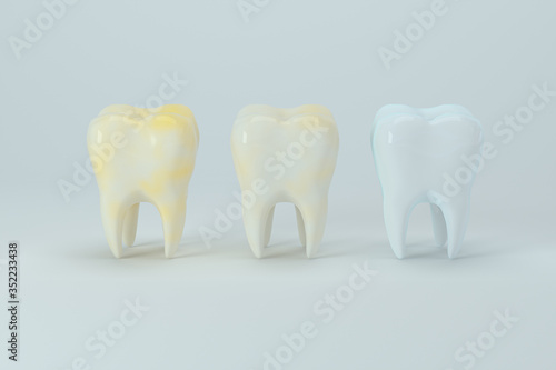 Changing of the tooth color from yellow to white  3d rendering.