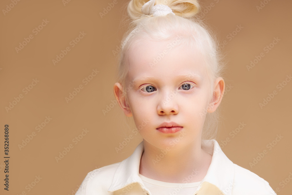 portrait of albino kid girl with white skin and white hair. Blonde girl ...