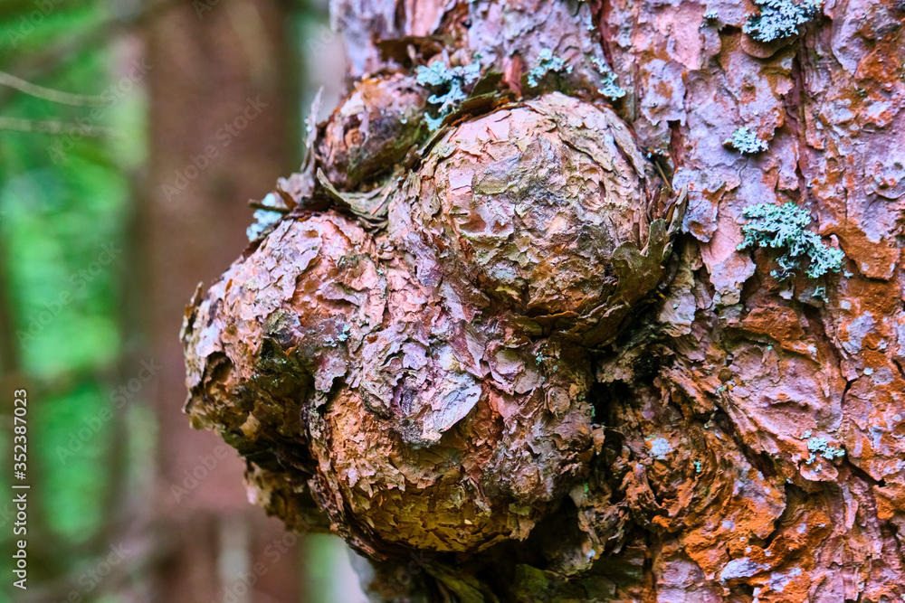 Huge excrescence on pine tree trunk. Sick diseased forest tree. color ...