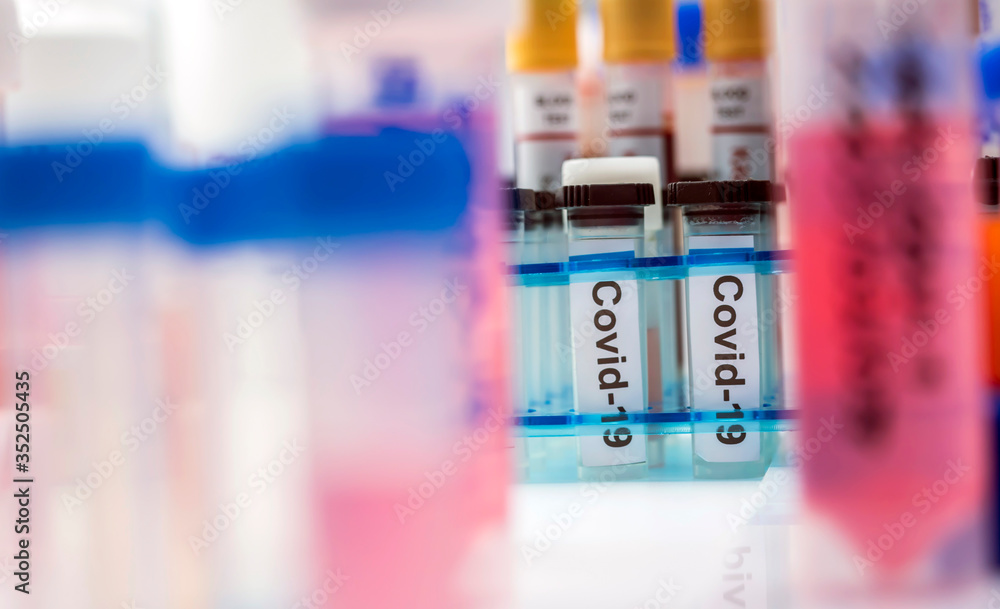 Vials with samples of SARS-COV-2 Covid-19 in a research laboratory, conceptual image Vials with samples of SARS-COV-2 Covid-19 in a research laboratory, conceptual image