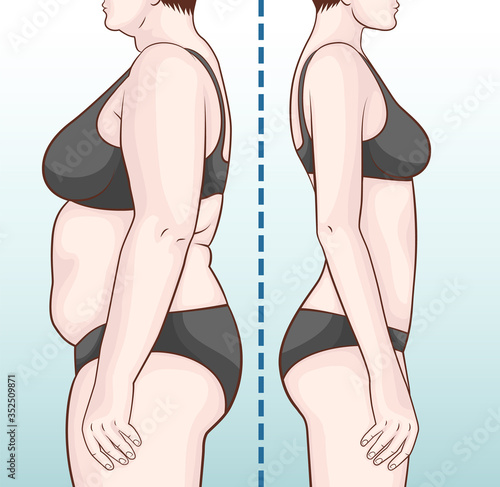 Before and after losing weight. Woman before and after diet and fitness. Weight loss concept.