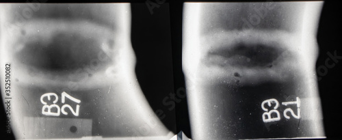 Foto X-ray image of the welding seam with defects