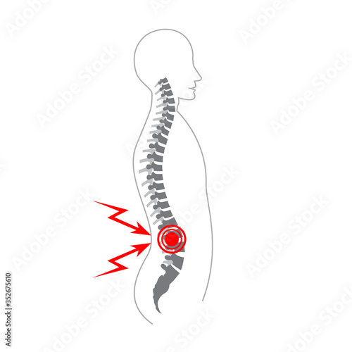 Human spine pain vector illustration. Medical, educational and science banner.