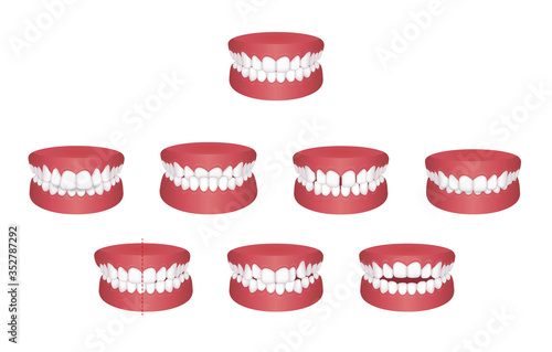 Teeth trouble ( bite type ) vector illustration set