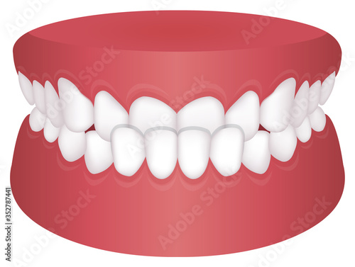 Teeth trouble ( bite type ) vector illustration /Underbite photo
