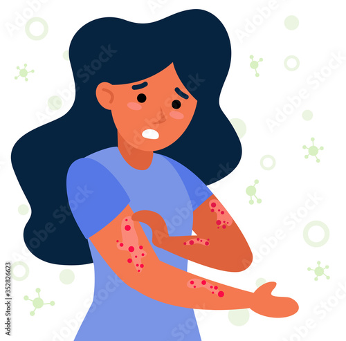 Woman with strong allergy symptoms flat vector illustration. Cartoon sad character scratching skin, itching and suffering. Virus disease and eczema concept