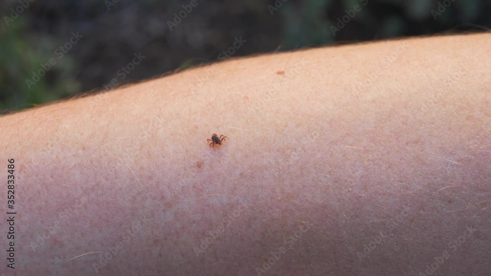 Stockvideon Small Insect Parasite Mite Crawls On a Man's Hand. Tick on ...