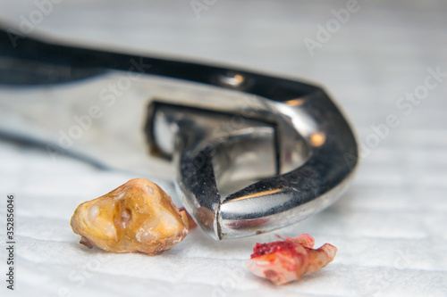 extracted dog teeth and extraction pliers close-up photo