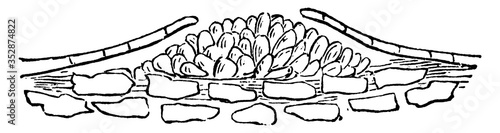 cyst, vintage illustration.