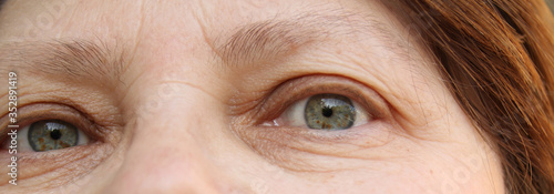 eyes of an elderly woman with wrinkles on the eyelids, part of the face close-up, overhang, the concept of age-related changes in human skin