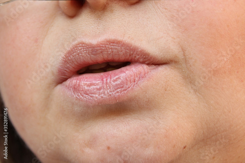 lips  mouth and chin of a middle-aged woman  part of the face close-up  fine wrinkles on the face  spots  the concept of cosmetic anti-aging procedures  facial massage