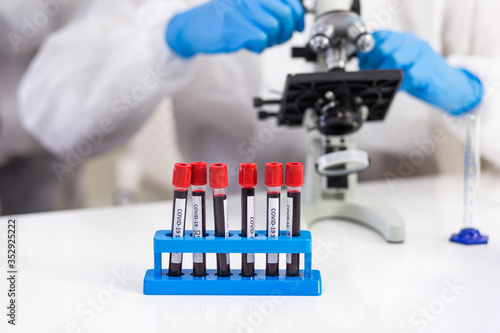 Rack of blood tubes with a label for virus identification is placed in front of a microbiologist who is working in the laboratory.