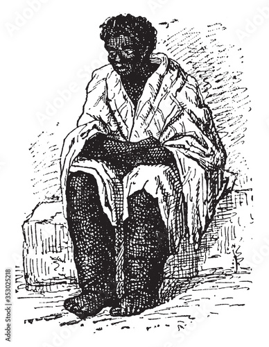 Elephantiasis, vintage illustration.