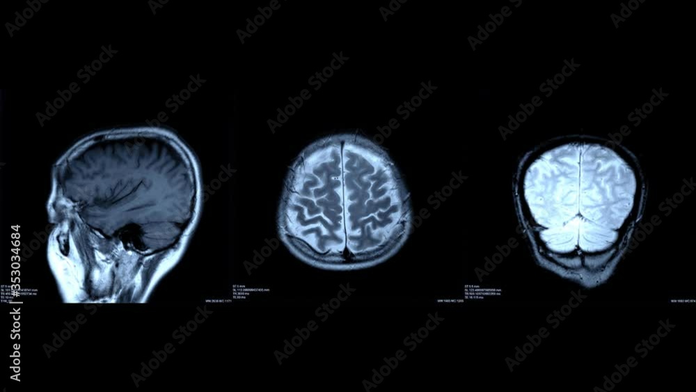 x-ray image of brain scan by mri or ct scan. radiology,radiation or medical imaging concept. x-ray image of brain scan by mri or ct scan. radiology,radiation or medical imaging concept.