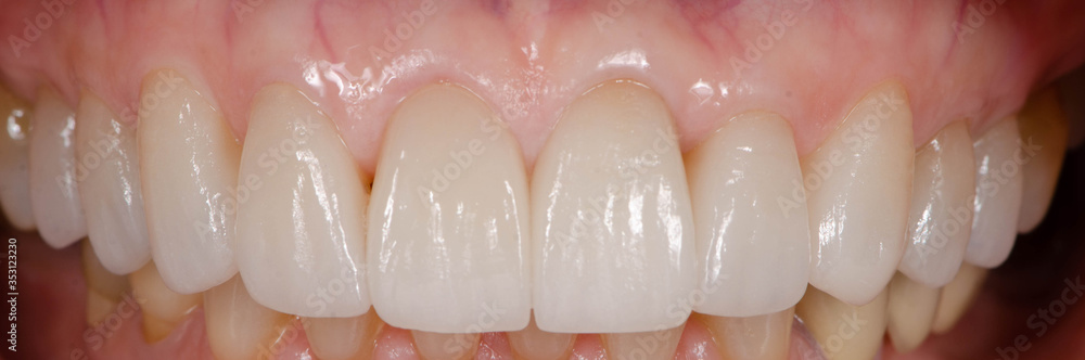 Fototapeta premium The various style of teeth