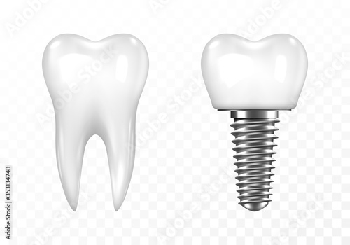 Human tooth and Dental implant on transparent background