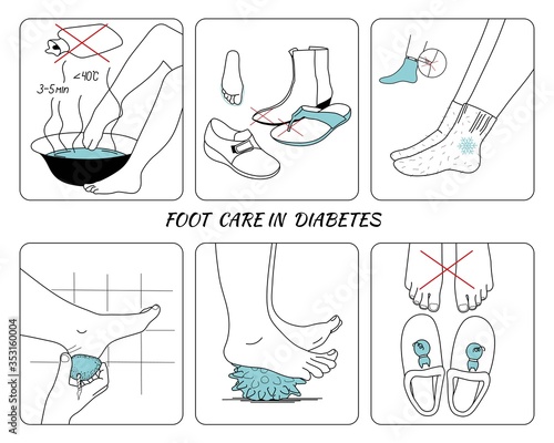 Prevention of diabetic foot