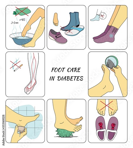 Preventive foot care in diabetes