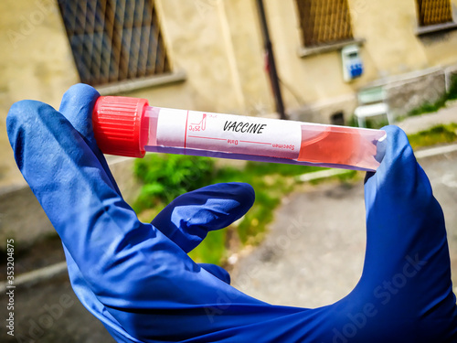 Test Tube used for the coronavirus treatment photo