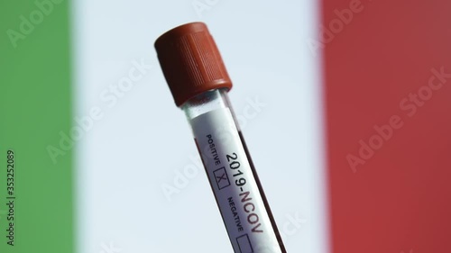 Corona virus or Covid-19 in Italy , sample blood tube with Italy flag on background