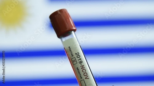 Corona virus or Covid-19 in Uruguay , sample blood tube with Uruguay flag on background