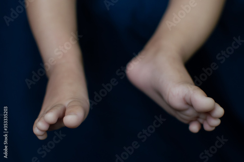 Infant legs close up with open legs