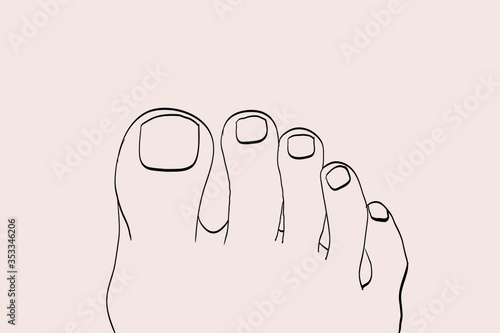 foot drawn with podiatry problems. Fingers and nails to be restored for the podiatrist. Linear illustration