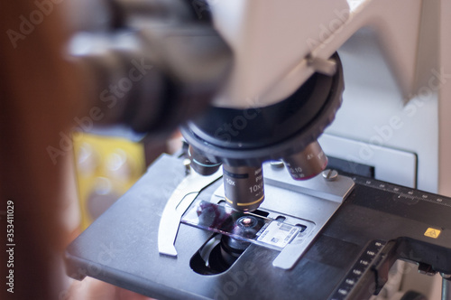 diagnostico de citologia en microscopio