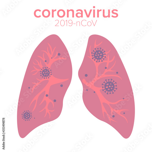 Coronavirus infected lungs vector illustration. 