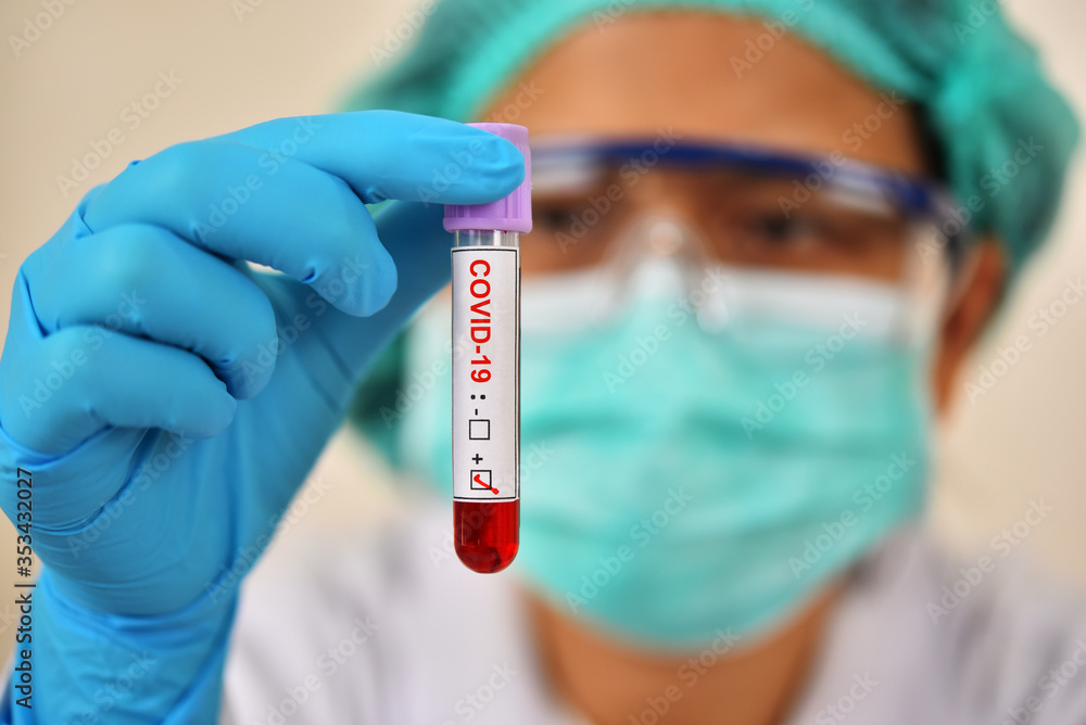 Lab technician holding blood sample tube positive with COVID-19 Lab technician holding blood sample tube positive with COVID-19
