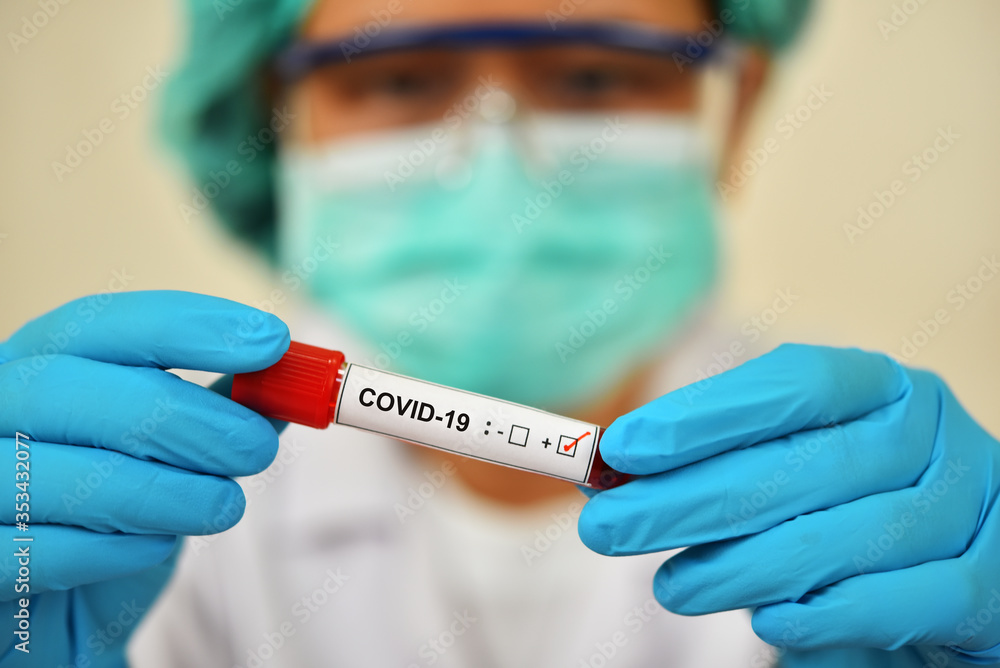 Lab technician holding blood sample tube positive with COVID-19 Lab technician holding blood sample tube positive with COVID-19