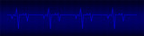 Heart rhytm. Blue electrocardiogram. Heartbeat. Heartbeat line. Vector illustration.