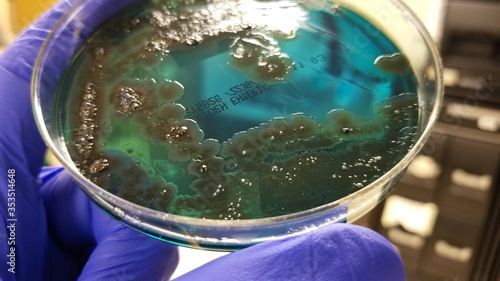 Salmonella black colonies and Pseudomonas on Chromogenic Agar photo