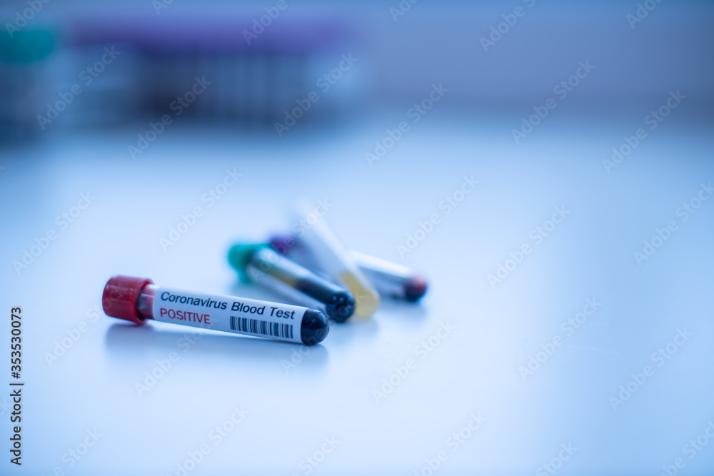 Obraz premium Corona-19 Virus Diagnostic Laboratory, select focus